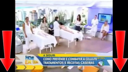 Como prevenir e acabar com a celulite