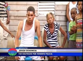 Hombre denuncia paliza por parte de un teniente y dice lo siguiente ante las camaras