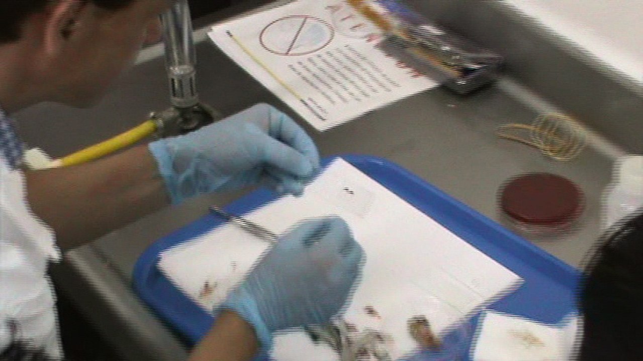 Obtencion muestra para bacteriología  y parasitología