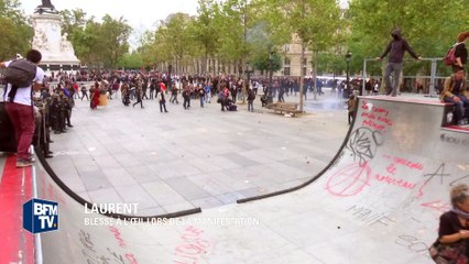 Manifestation anti-loi Travail: il a perdu son œil et ne comprend pas que "les CRS aient agi de telle manière"