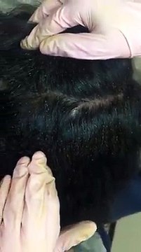 Eso no son piojos, es ¡un nido de piojos!. ¿Cómo dejan así a la niña?