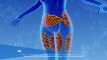 What is the CoolSculpting procedure
