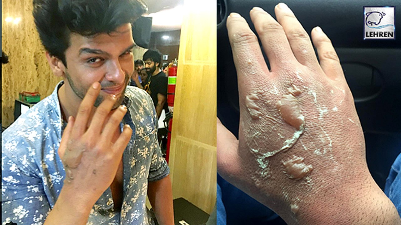 Kushal Tandon BURNT On 'Beyhadh' Set | Jennifer Winget | Aneri Vajani