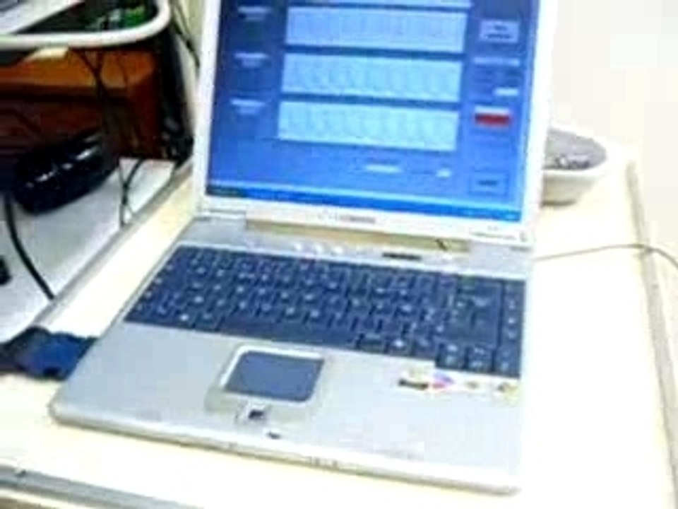 Electrocardiogramme