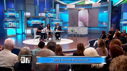 Belly Button Blackhead!