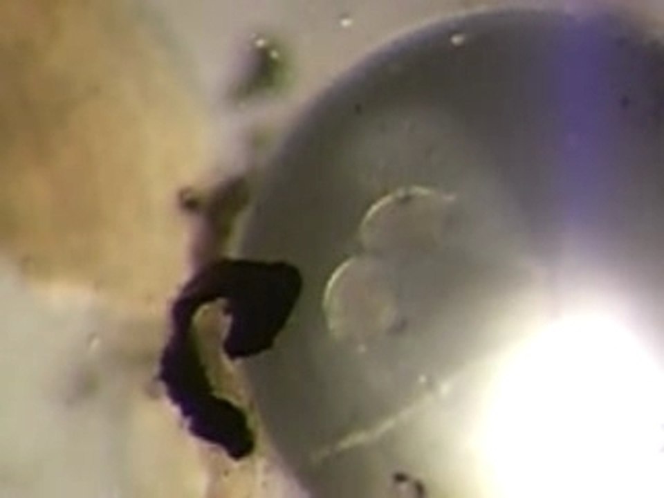 Diplostomum