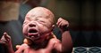 Sezaryen Sonrası Normal Doğum Olur mu?