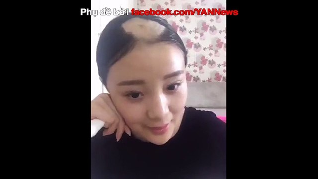 Cô gái trọc đầu vì ăn bắp trở lại với clip hướng dẫn... giúp mọc tóc