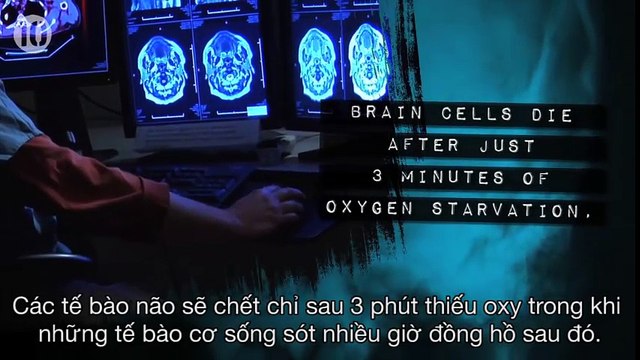 10 điều tiếp tục xảy ra trên cơ thể người đã chết