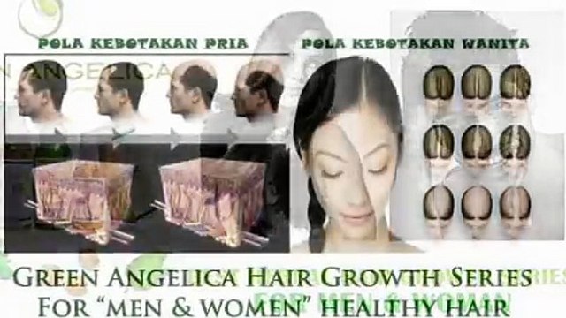 Penumbuh rambut botak cepat, penumbuh rambut di jidat, perontok bulu, penumbuh rambut lebat alami