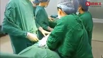 Cận cảnh một cuộc phẫu thuật độn bắp chân nội soi ở Hà Nội