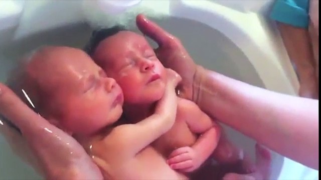 Cặp song sinh quấn quýt nhau mà không nhận ra mình đã được sinh ra đời. Khoảnh khắc thật kỳ diệu
