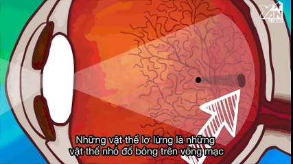 Sự thật về những vật thể lơ lửng bên trong mắt bạn luôn nhìn thấy