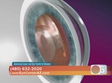 Advanced Laser and Eye Center of Arizona offers dropless cataract surgery