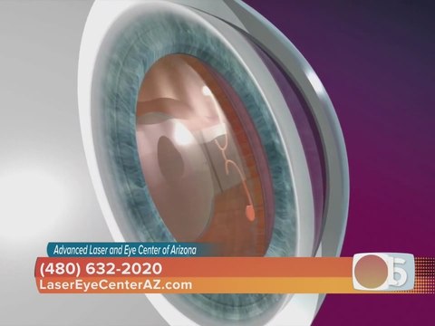 Advanced Laser and Eye Center of Arizona offers dropless cataract surgery