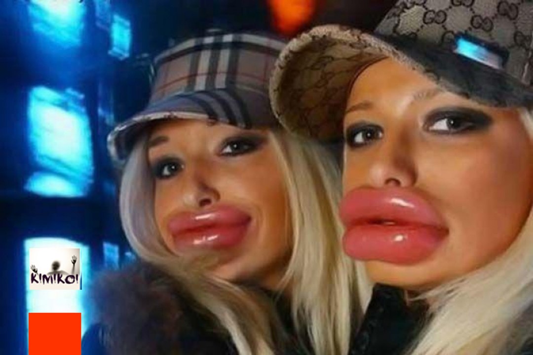 Les 10 Plus Gros RATÉS de la chirurgie esthétique chez des Stars !