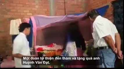 Xót thương người đàn ông ở Tiền Giang còn 1 nửa khuôn mặt vì bệnh lạ