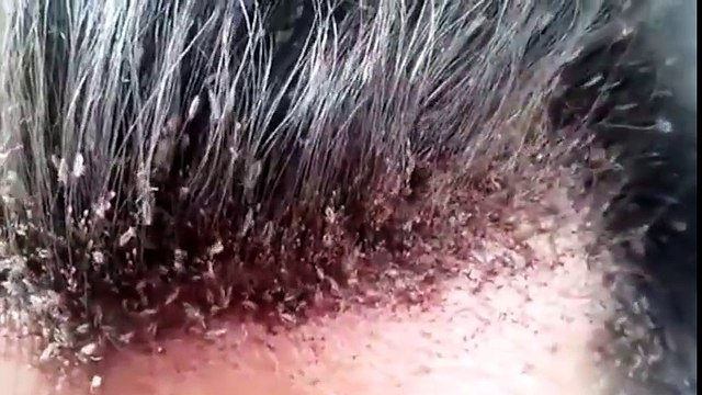 Người đàn ông bị trí tệ nhất thế giới