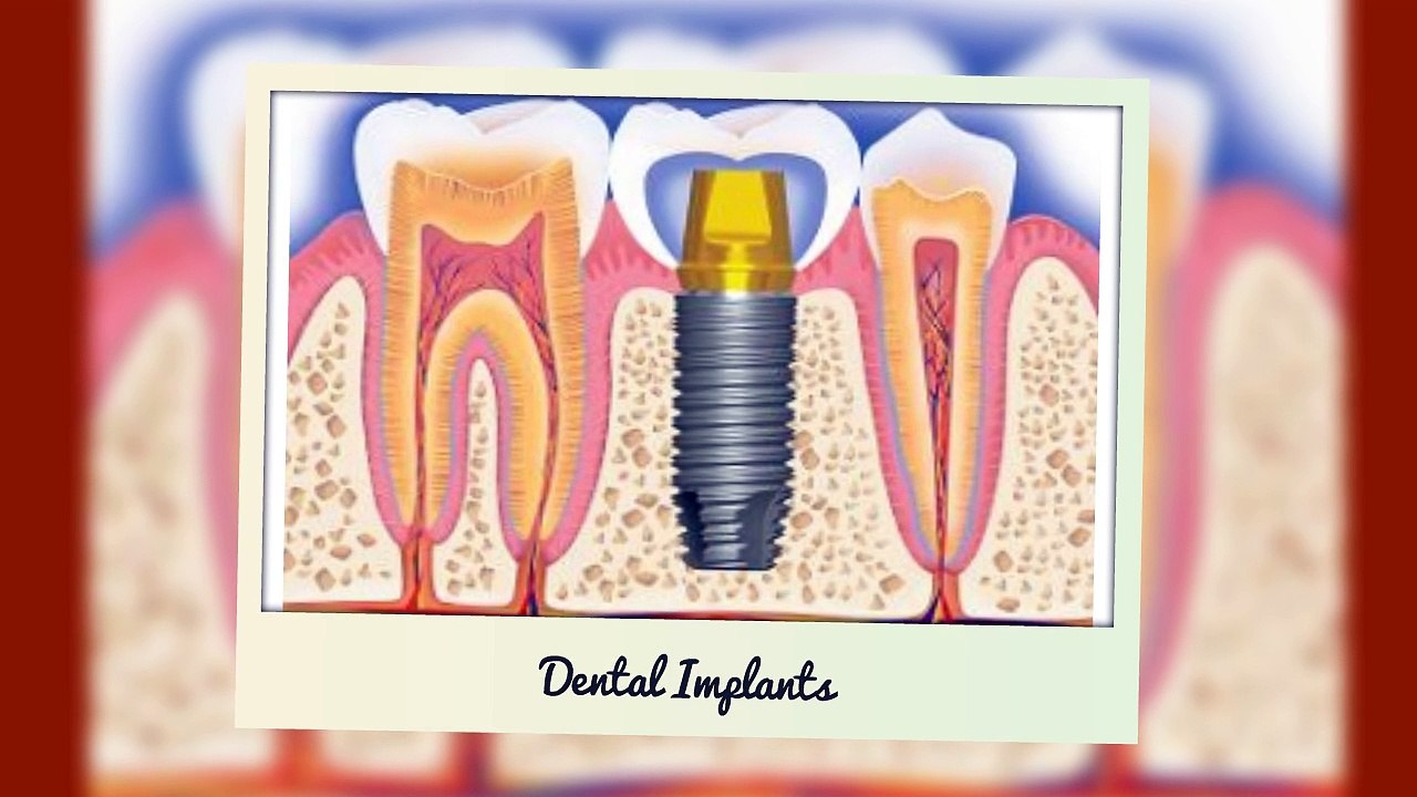 Let The Best Dentists In Balmain Take Care Of Your Teeth