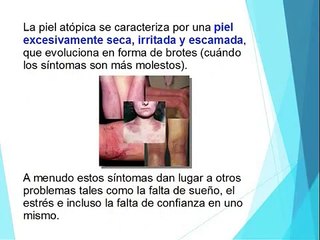 ¿Cómo cuidar la piel atópica?