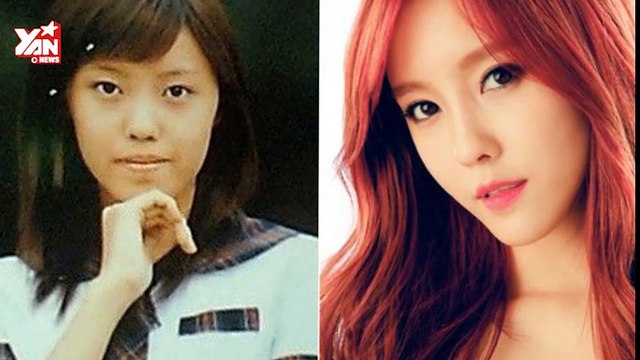 7 sao Hàn thừa nhận phẫu thuật thẩm mỹ