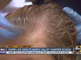 Super lice sweeping through schools in the North Valley