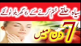 Dark Circles Treatment In Urdu Remove Dark Circles  RemeTips At Homedies Siyah Halke 2017