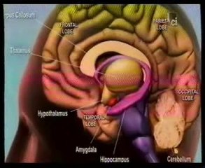 Demencia frontal: Autopsia forense