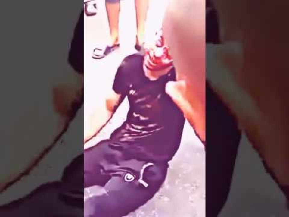 شفار مني حصل