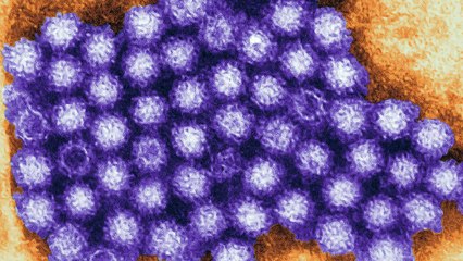 Norovirus Food Poisoning from Pesticides