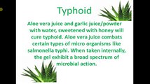 How to permanently cure Typhoid with aloe vera