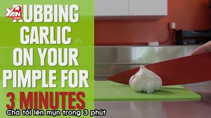 18 Pimple Hacks You Need To Try