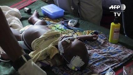 Millionen Kinder hungern in Nigeria