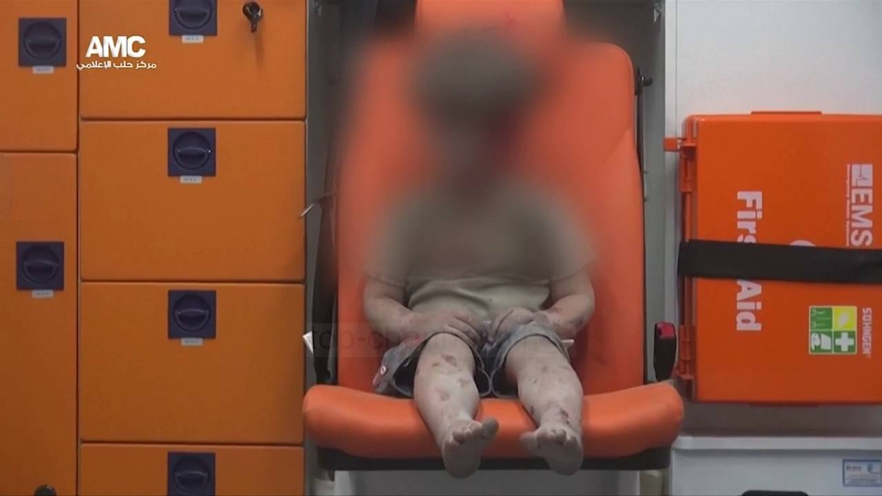 Videoja që tregon horrorin e luftës në Siri - Top Channel Albania - News - Lajme