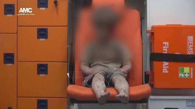 Videoja që tregon horrorin e luftës në Siri - Top Channel Albania - News - Lajme