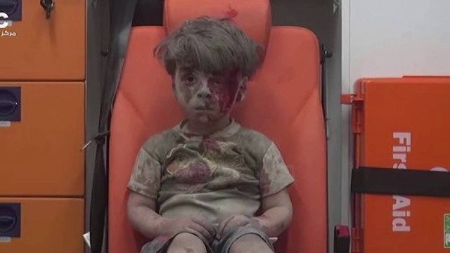 Videoja që tregon horrorin e luftës në Siri - Top Channel Albania - News - Lajme