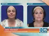 CoolBody Contours offers a facelift without surgery