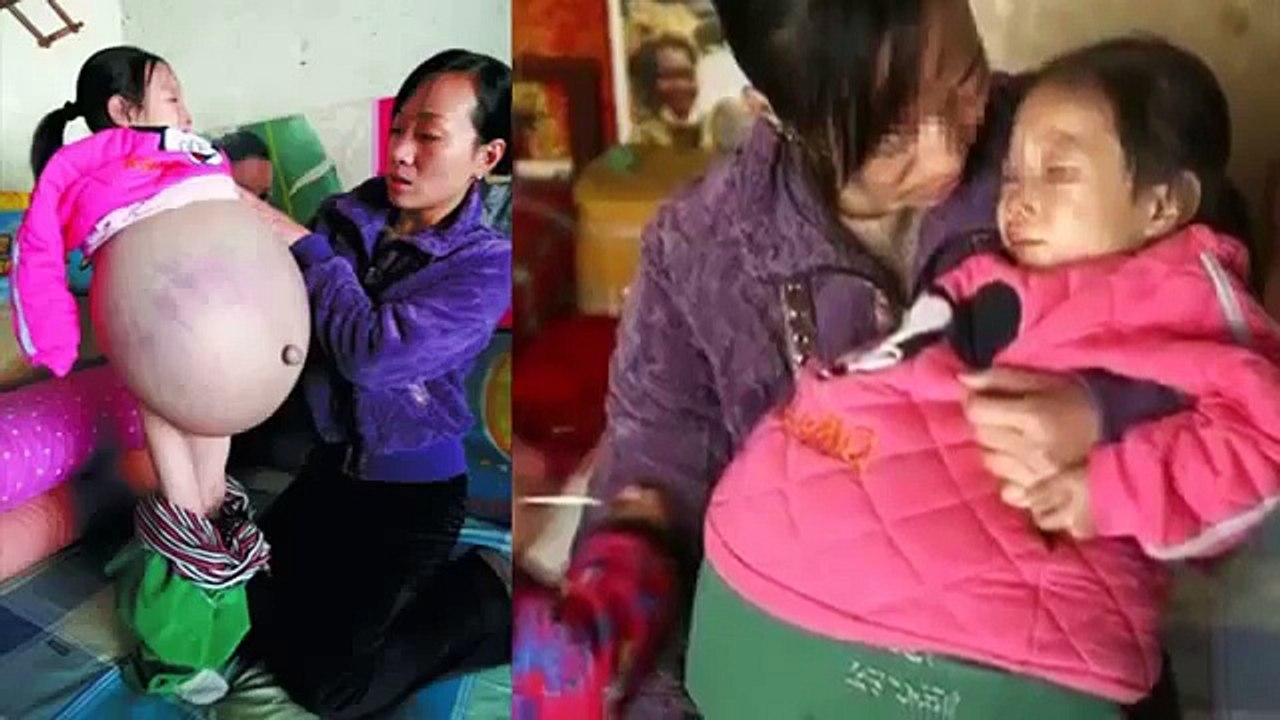 4 Years Old Girl Has 9 Months Pregnants Stomach