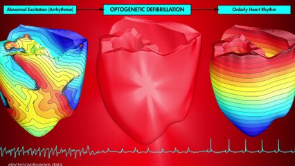 Desfibrilación óptica, según los investigadores de la Universidad Johns Hopkins