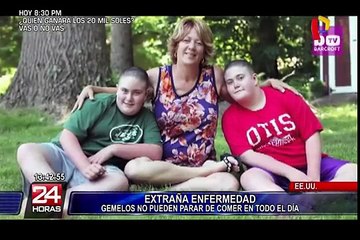 Gemelos de 12 años con apetito insaciable preocupa a médicos en Estados Unidos