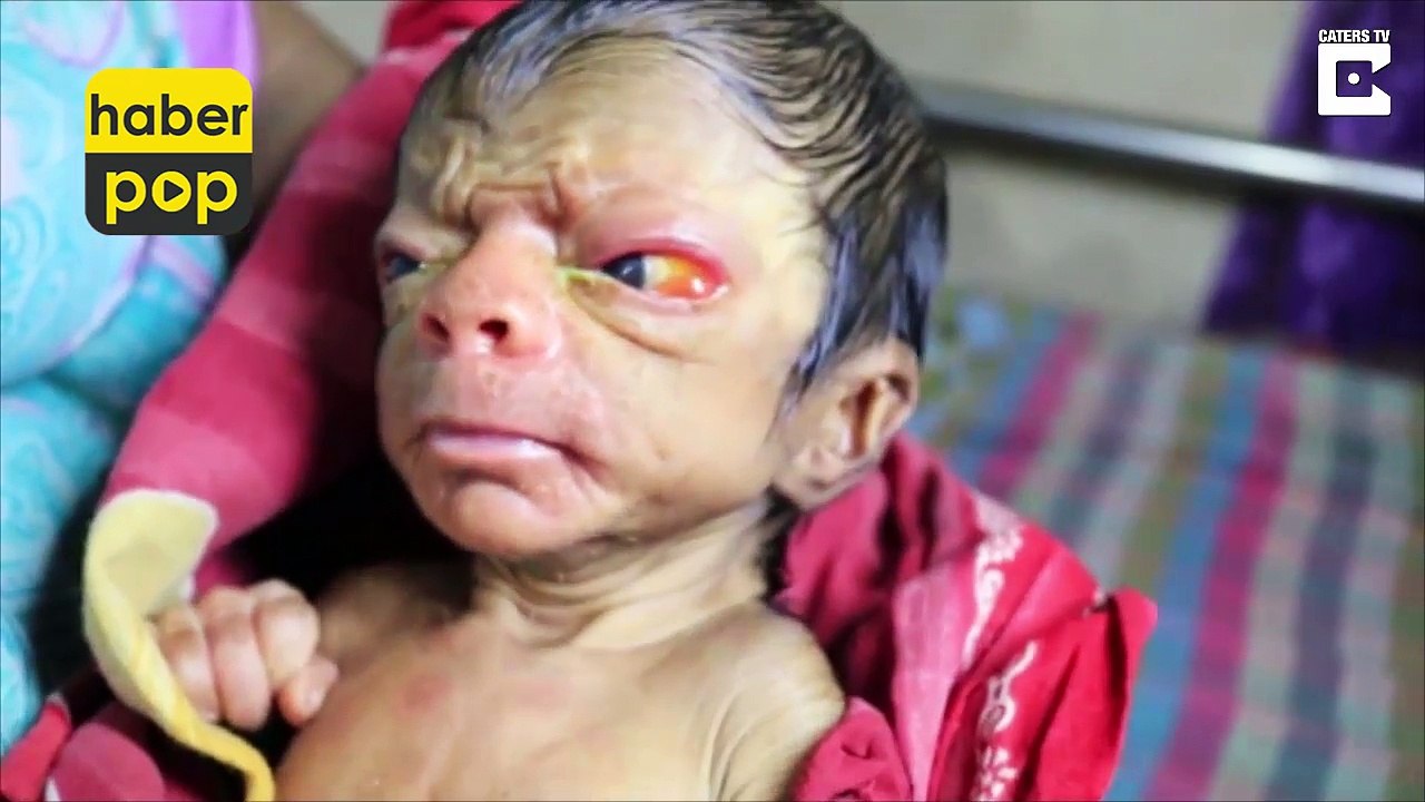 Yaşlı doğan bebek #yaşlı #bebek