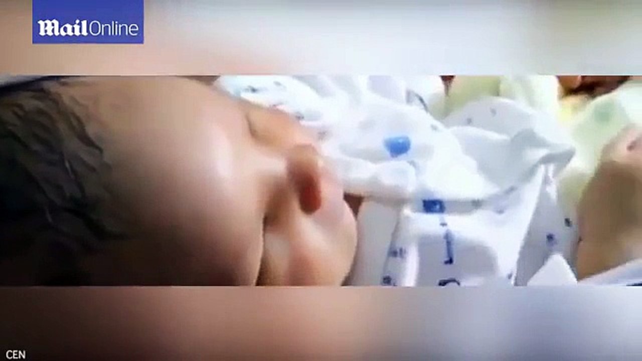 New born baby without eyes in China