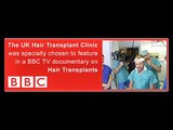 Why we go bald - hair loss explained: Excerpt from BBC Documentary on Hair Transplants