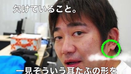 【超絶悲痛】メッセンジャー黒田の耳たぶがヤバい…その原因を聞いてフルえたwwwwww