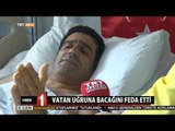 Vatan Uğruna Bacağını Feda Etti - 15 Temmuz Darbe Girişimi - TRT Avaz
