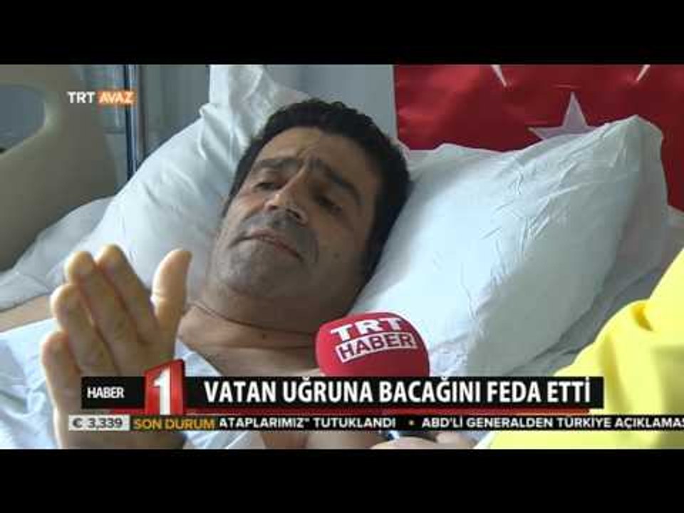 Vatan Uğruna Bacağını Feda Etti - 15 Temmuz Darbe Girişimi - TRT Avaz