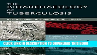 New Book The Bioarchaeology of Tuberculosis: A Global View on a Reemerging Disease