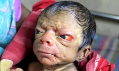 Üç Günlük Bebeğin Fiziksel Görünümü 80 Yaşındaki İnsanı Andırıyor