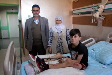 Parçalanan Bacağı, Diğer Bacağından Alınan Kemik ve Dokularla Kurtarıldı