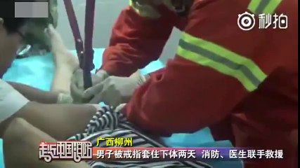 Man gets penis stuck in wedding ring